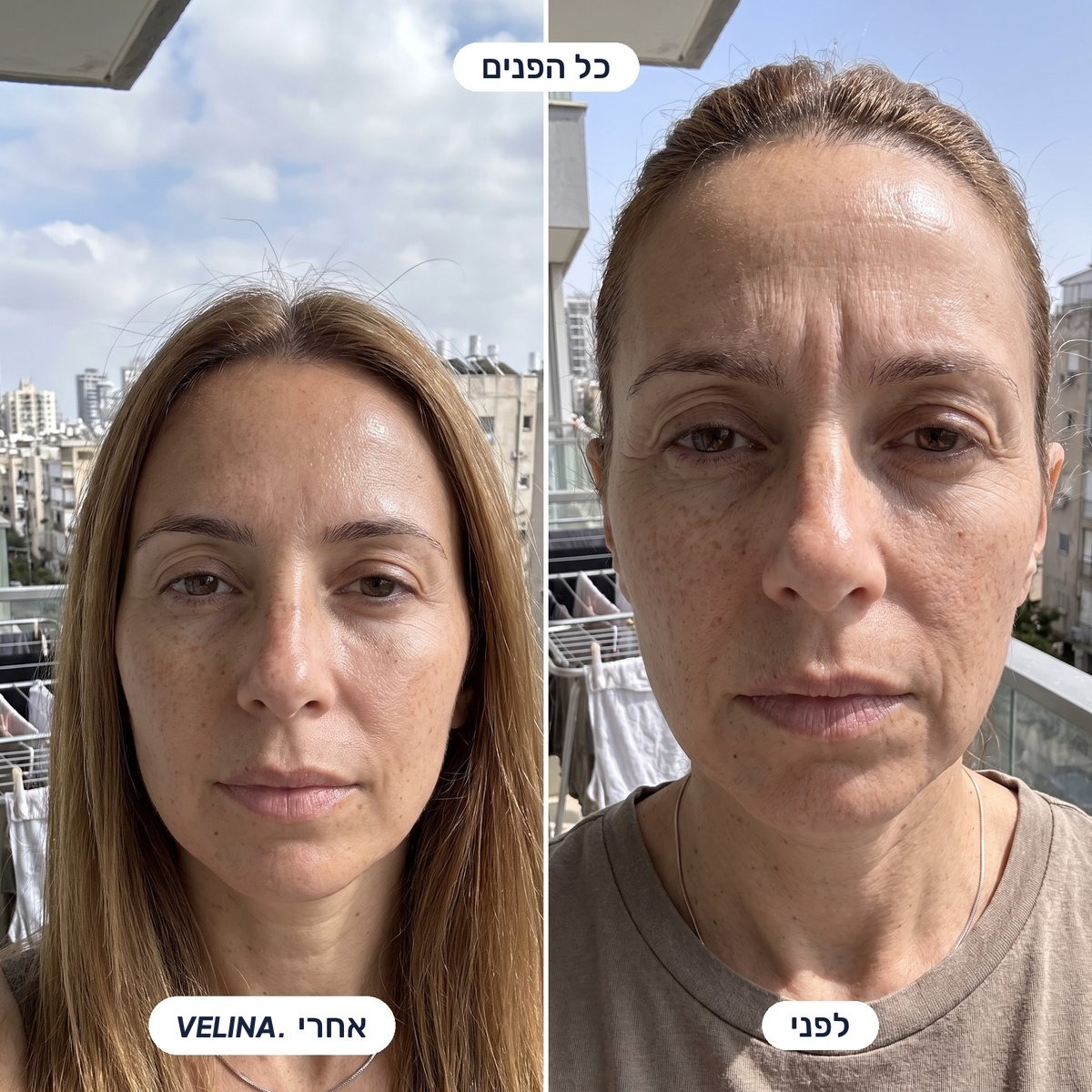 לפני ואחרי - כל הפנים