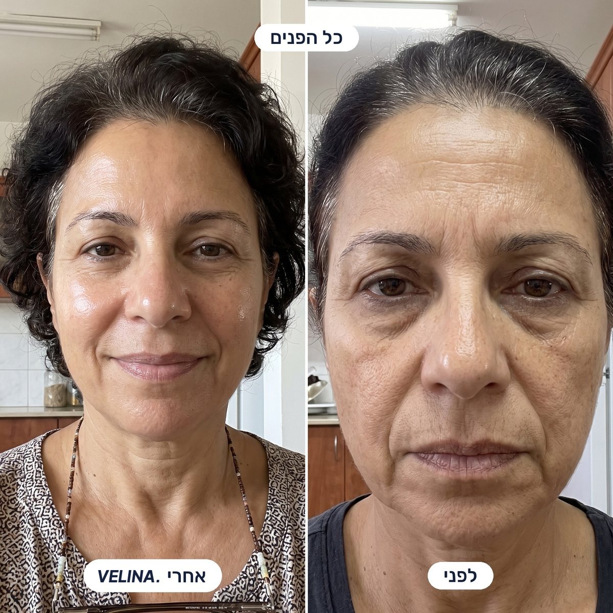 לפני ואחרי - כל הפנים